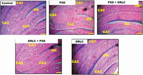 Figure 4. Representative photomicrographs showing the general morphology of the hippocampus of the Wistar rats across the various groups stained with H & E. (Scale bars: 50 µm). the Dentate Gyrus (DG) composed of granule cells, Cornu amonus (CA1-3) containing pyramidal cells, are well demonstrated across the experimental groups.