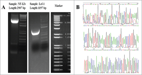 Figure 1. Plasmid construction. (A) Enzyme digestion analysis of NF-κB and Lef-1 transgene vectors. Markers and (Sample) fragments of pcDNA3.1(+)-NF-κB and pcDNA3.1(+)-Lef-1 plasmid separately digested by HindIII and PstI/SalI. (B) Gene sequencing analysis. This image depicts the gene sequences of the Homo sapiens NF-κB and Lef-1 from GenBank (Serial Number: NM_003998 and NM_016269).