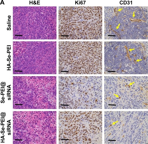 Figure 9 (A) H&E, Ki67, and CD31 immunohistochemistry analysis of the tumors treated with saline, HA-Se-PEI, Se-PEI@siRNA, and HA-Se-PEI@siRNA. Yellow arrows were employed to highlight the immunohistochemical characteristics. Scale bar is 50 μm. (B) H&E analyses of heart, liver, spleen, lung, and kidney after treatment with saline, HA-Se-PEI, Se-PEI@siRNA, and HA-Se-PEI@siRNA, respectively. Scale bar is 50 μm.Abbreviations: HA, hyaluronic acid; H&E, hematoxylin and eosin; PEI, polyethylenimine; Se, selenium; siRNA, small interfering RNA.