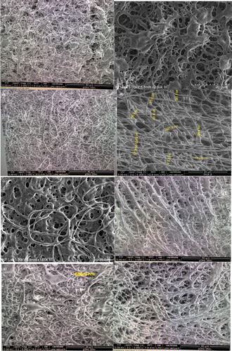 Figure 5. Morphological features of P(3HB-co-11.8 mol% 3HHx) electrospun at (a) 15 kV; (b) 18 kV; (c) 20 kV; (d) 25 kV and (e) 30 kV and P(3HB-co-8.4 mol% 3HHx) in CHCl3:DMF (ratio:8:2) electrospun at (f) 15 kV; (g) 20 kV and (h) 30 kV. Both these commercial polymer solutions were electrospun at constant extrusion rate: 40 μL/min, using 10 w/v % solution in CHCl3:DMF mixed solvent (ratio:8:2).