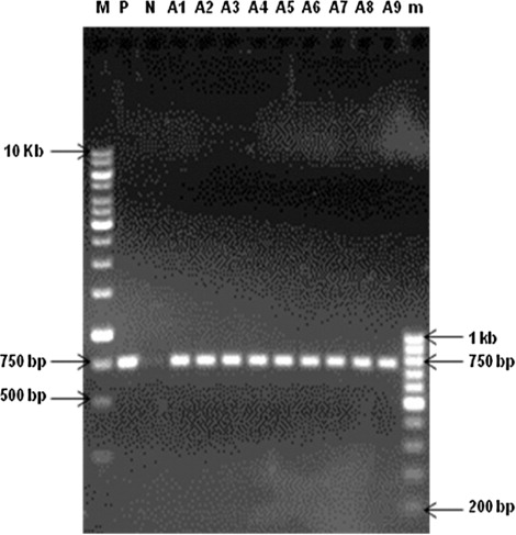 Figure 1. PCR analysis of A. annua L. hairy root lines for the presence of the rol B gene. Lanes: M, 1 kb ladder; P, positive control (Agrobacterium rhizogenes plasmid harboring rol B gene); N, negative control (normal roots of A. annua L.), A1–A9, hairy root lines of A. annua L. plants; m, 100 bp ladder.
