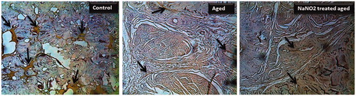 Figure 6. Immunohistochemical localization of eNOS in rat penis (40 × magnification) from young control, aged and NaNO2-treated aged rats. Please notice the eNOS staining (dark brown) with decreased localization to the cavernous and vascular areas from aged groups. The negative control section processed without antibodies did not stain (data not shown).
