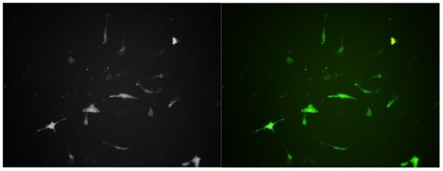 Figure 4 Human vascular smooth muscle cells transfected with pEGFP delivered with APTES-SiNPs. A combined transmission and fluorescence image is shown. Fluorescence spectra of pEGFP taken in human vascular smooth muscle cells (magnification 400×).Abbreviations: APTES, aminopropyltriethoxysilane; SiNPs, silicon dioxide nanoparticles; pEGFP, plasmid encoding for enhanced green fluorescent protein.