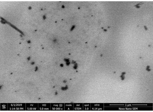 Figure 6 Transmission electron microscopy of prepared nanoparticle (NPs) at 1 μm.