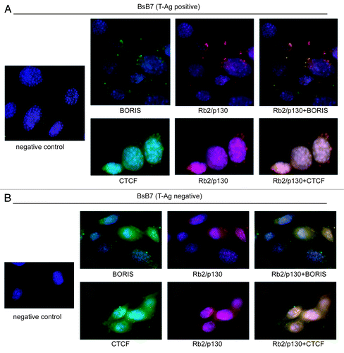 Figure 3. (A) Mapping of the regulated phosphoproteome to the autophagosomal interaction network (AIN) as reported by Behrends et al.Citation14 The AIN was subdivided into the ‘autophagy interactome’ (AI), the ‘central autophagy interactome’ (CAI) and the ‘autophagy core network’ (ACN). Possible false-positives retrieved fromCitation34 were included for validation. (B) Heatmap of cluster-specific autophagy responsive phosphoproteins mapped to CAI and ACN.