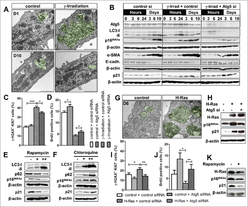 Figure 2. Experimental modification of autophagy influences senescence marker expression and epithelial phenotype under pro-senescent stress conditions in renal primary tubular epithelial cells (PTEC). PTEC underwent established models of senescence induction using γ-irradiation (10 Gy) or retrovirus-mediated overexpression of constitutively active mutant H-Ras. In parallel, autophagy was suppressed by siRNA mediated knock down of Atg5. (A) Representative electron microscopy images from PTEC showing (a) presence of massive autophagy related structures (defined as early double membraned structures surrounding cellular content as well as later stages, where the inner membrane has already become indiscernible) at day 1 (b) a decline in autophagy at day 10 after γ-irradiation. (B) Immunoblots for Atg5, LC3, p16INK4, α-smooth muscle actin (α-SMA), E-cadherin (E-cadh.) and p21 in γ-irradiated PTEC treated with Atg5 or control siRNA. (C, D) Quantification of γ-H2AX+/Ki67− cells and BrdU incorporation in γ-irradiated PTEC treated with Atg5 or control siRNA. (E, F) Representative immunoblots for LC3, p62, p16INK4a and p21 in γ-irradiated PTEC treated with rapamycin or chloroquine. (G) Representative electron microscopy images from PTEC showing presence of large autophagy related structures at day 6 after H-Ras transduction. (H) Immunoblots for H-Ras, p16INK4a and p21 expression in Atg5 siRNA treated H-Ras transduced PTEC. (I, J) Quantification of γ-H2AX+/Ki67− cells and BrdU incorporation in H-Ras transduced PTEC after Atg5 or control siRNA treatment. (K) Representative immunoblots for H-Ras, p16INK4a and p21 upon rapamycin treatment in H-Ras transduced PTEC. Scale bar 1 µm in A and G. Data is presented as mean ± SEM. n = 7. *P < 0.05; **P < 0.005; ***P < 0.001.