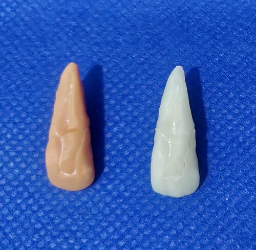 Figure 4. Models of reconstructed teeth which were printed using tooth printed by stereolithography technique (SLA) and tooth printed by fused deposition modelling technology (FDM) techniques (left to right, respectively).