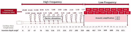 Figure 2. Schematic representation of electric stimulation in the HF region and acoustic amplification in the LF region in an average-sized cochlea (image courtesy of MED-EL).