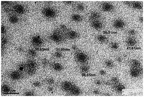 Figure 5. TEM photomicrographs of optimized nanoemulsion.
