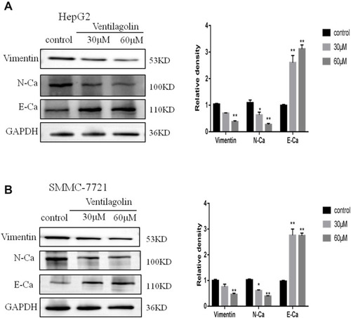 Figure 2 Ventilagolin inhibits EMT of HCC cells. (A and B) HepG2 and SMMC-7721 cells were treated with 30 μmol/L and 60 μmol/L Ventilagolin, and the protein levels of E-cadherin (E-Ca), N-cadherin (N-Ca), Vimentin were determined by Western blot using GAPDH as an internal reference. Data are expressed as mean ± SEM from three independent experiments. The relative expression levels were quantified by ProteinSimple analysis software. * and ** respectively indicate significant difference at P < 0.05 and P < 0.01 as compared to the control group.