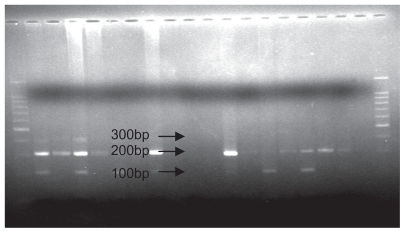Figure 3 Polymerase chain reaction restriction fragment length polymorphism analysis results of SDF1 followed by enzymatic digestion on 1.5% agarose gel (genotype observed, G/G).