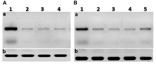 Figure 8 (A) The scanned densitometry Western blot of viral replication in Huh7 (a) versus β-actin (b); lane 1, protein levels of infected untreated cells: lane 2, infected cells treated with curcumin: lane 3, infected cells treated with CsNPs: lane 4, infected cells treated with curcumin chitosan nanocomposite. (B) The scanned densitometry western blot of viral entry (a) versus β-actin (b) protein levels in positive; lane 1, untreated infected cells: lane 2, cells treated with curcumin: lane 3, cells treated with CsNPs: lane 4, cells treated with curcumin chitosan nanocomposite: lane 5, cells treated with sofosbuvir. HCV core protein at size of 22 KD.