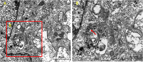 Figure 7 TEM analysis of adenovirus virions in airway organoids. (A). The nucleus and cytoplasmic region of the cells in the airway organoids (B). The region where adenovirus particles appear in the cytoplasm. Virus-like particles are indicated by the red arrows.