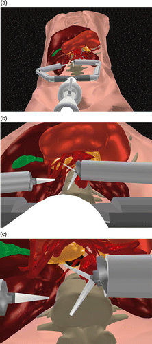 Figure 3. Available viewing modalities: (a) panoramic, (b) from the access port camera, and (c) from the robot camera.