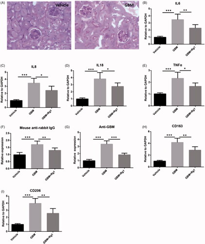 Figure 5. Rg1 improved anti-GBM glomerulonephritis induced inflammation in vivo. (A) Immunostaining showed that anti-GBM glomerulonephritis model was successfully constructed. (B–E) Rg1 decreased expression of inflammatory cytokines in anti-GBM glomerulonephritis model via RT-PCR analysis (n = 6). (F–I) Rg1 attenuated immune response induced expression of total IgG, anti-GBM, CD163 and CD206. *p < .05; **p < .01; ***p < .001; versus respective control.