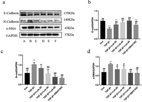 Figure 4. Lok inhibits EMT in BESA-2B cells exposed to TGF-β1. (a) The expression of E-cadherin, N-cadherin and α-SMA was detected by Western blot. A: control, B: TGF-β1 (10 ng/mL), C: TGF-β1 with Lok (10 ng/mL and 20 µg/mL respectively), D: TGF-β1 with Lok (10 ng/mL and 40 µg/mL, respectively), E: TGF-β1 with Lok (10 ng/mL and 80 µg/mL, respectively), F: TGF-β1 with SB431542 (10 ng/mL and 5 μM, respectively). Ratios of E-cadherin (b), N-cadherin (c) and a-SMA (d) intensity. The obtained data are expressed as mean ± SD. n = 3, *p < 0.05, **p < 0.01, vs. con, #p < 0.05, ##p < 0.01, vs. TGF-β1.