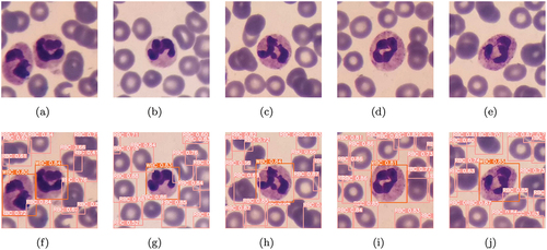 Figure 9. Visualization detection results on raabin-WBC dataset. Top to bottom: (a)–(e) Original image; (f)–(j) Detection results of the DWS-YOLO.