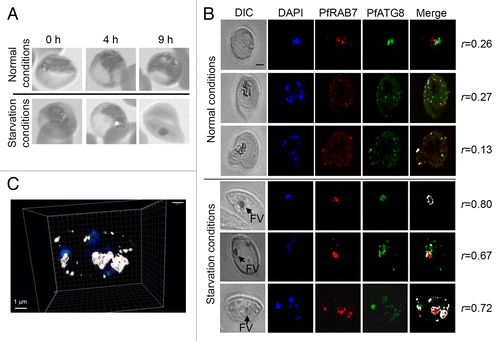 Figure 2. Amino acid deprivation induces fusion between PfRAB7-positive and PfATG8-positive compartments. (A) Morphological changes observed in P. falciparum-infected erythrocytes in Giemsa stained thin smears 4 h and 9 h after amino acid-deprivation [Zeiss Axio Observer.Z1 microscope with CoolSNAP HQ2 Camera, 100× phase contrast objective (Photometrics)]. (B) Association of PfRAB7 and PfATG8 under normal or amino acid-deprivation conditions using IFA. The distribution of PfRAB7 (red: excitation: 530 to 560 nm and emission 572 to 647 nm; anti-PfRAB7 peptide antibody) and PfATG8 (green: excitation: 450 to 490 nm and emission 500 to 550 nm; anti-PfATG8 peptide antibody) is shown. Nuclei are stained with DAPI (blue: excitation: 340 to 380 nm and emission 450 to 490 nm). The association of PfRAB7 and PfATG8 is shown in white (merge). The images were obtained using a Leica DMI 6000 microscope with MicroMAX-1300Y/HS camera (Princeton Instruments). The Pearson’s coefficient (r) represents the degree of colocalization between PfRAB7 and PfATG8 in the individual images. FV: food vacuole. (C) Volumetric 3D-reconstruction of IFA images using Imaris (Bitplane) corresponding to the Z-stacks taken for the cell in the lowest panel of (B) (r = 0.72) (Leica DMI 6000 microscope with MicroMAX-1300Y/HS camera). The association between PfRAB7 (red) and PfATG8 (green) is shown in white. Nuclei are stained with DAPI (blue). Scale bar: 1 µm.