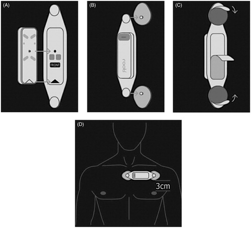Figure 1. The cuffles blood pressure device Rooti RX. (A) Fixing of the device on the patch; (B) connection of the patch to the electrodes; (C) exposure of the adhesive part of the electrodes; (D) fixing the electrodes to the skin.