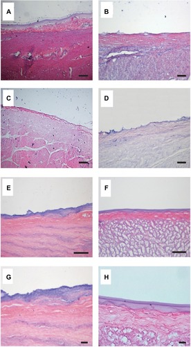 Figure 8 H&E-stained histological sections of artificial ulcers with collagen sols.