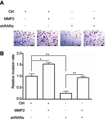 Figure S1 Rescue of MMP2 expression in RARα-knockdown RKO cells restored cell invasionNotes: (A) Cell invasion was performed by transwell assays. Scale bar, 20 μm. Assays were independently repeated in triplicate. (B) Quantitative analysis of invasion cells. *P < 0.01, **P< 0.001.