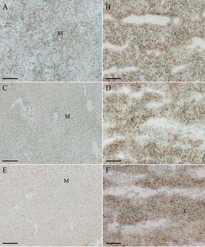 Figure 1. In situ hybridization of Ang-1, Ang-2 and Tie-2 expression in sika deer antler. (A), Ang-1 expression in antler mesenchyme. (B), Ang-1 expression in antler cartilage. (C), Ang-2 expression in antler mesenchyme. (D), Ang-2 expression in antler cartilage. (E), Tie-2 expression in antler mesenchyme. (F), Tie-2 expression in antler cartilage. M, mesenchymal cells; C, chondrocytes. Bar = 60 μm.