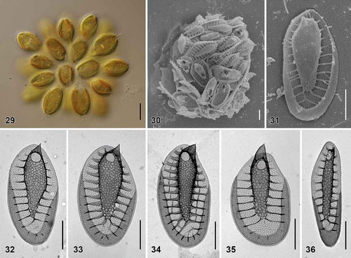 Figs. 29–36. Scale morphology of Synura laticarina sp. nov. (Fig. 29: LM; Figs 30 and 31: SEM; Figs 32–36: TEM). Scale bars represent 10 μm (Fig. 29) and 1 μm (Figs 30–36). Fig. 29. Colony consisting of pyriform cells (strain S 90.C8). Fig. 30. Single cell surrounded by a layer of siliceous scales (S 90.C8). Fig. 31. Body scale (S 90.C8). Fig. 32. Body scale with anteriorly widened keel (S 89.D5). Fig. 33. Body scale. Note over-layered pore pattern at the scale keel (S 89.D5). Fig. 34. Body scale with transverse folds interconnecting the struts (S 90.C8). Fig. 35. Apical scale (S 89.D5). Fig. 36. Rear scale (S 89.D5).