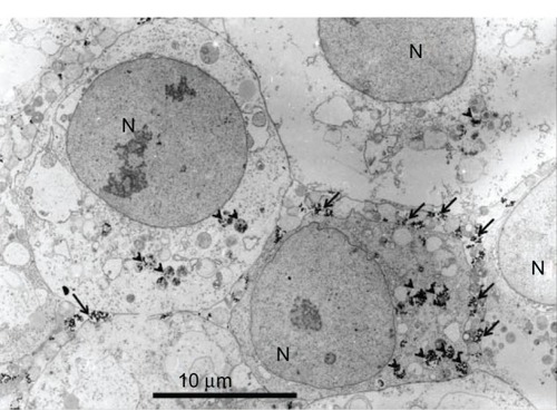 Figure 2 Transmission electron microscopy imaging of DU145 cells treated with 10 μg/mL of Fe3O4 magnetic nanoparticles.Notes: Arrow: extracellular magnetic nanoparticles; arrow head: intracellular magnetic nanoparticles.Abbreviation: N, nucleus.
