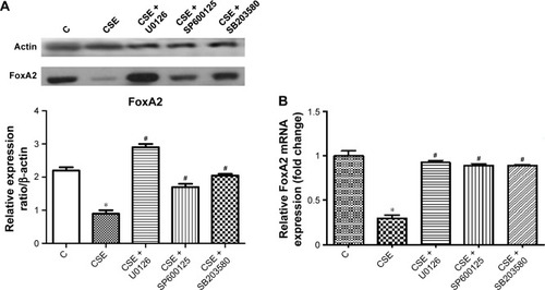 Figure 7 FoxA2 expression at the protein (A) and mRNA (B) levels in CS-treated bronchial epithelial cells.