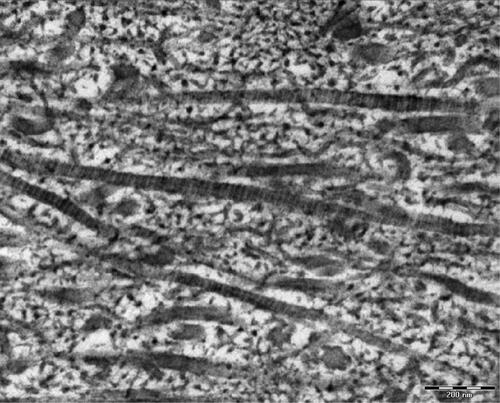 Figure 1. TEM micrograph (200 nm) showing banded fibrils characteristic of type II collagen in a CII-X sample.