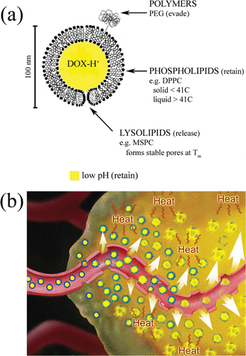 Figure 1. (a) Schematic of temperature-sensitive liposome structure. Liposomes are spherical lipid vesicles enclosing an aqueous compartment that contains drug. Amphiphilic drugs can be actively loaded and retained through a pH gradient. The phospholipid bilayer is characterized by a main melting phase transition. Lysolipids can form stable pores at the phase transition temperature. Polymers may be grafted onto lipids to evade immune recognition. Note that only unitary examples of each molecular strategy are shown. (b) Schematic of possible mechanisms involved in combination HT and liposomal therapy for solid tumours Citation[19]. (1) Liposomes (blue circles) preferentially extravasate from pores in tumour vessel walls. (2) HT increases tumour vessel pore size and thus increases tumour liposome extravasation. (3) HT can trigger drug (yellow) release from liposomes in the tumour vessel. (4) HT can trigger liposomal drug release in the tumour interstitium. (5) HT can be directly cytotoxic to tumour cells.