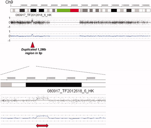 Figure 3. Analysis of SNP array genome profile showed that affected family members in addition to the 9.74 Mb region described in Figure 2, have a 1.2 Mb duplication in the region 20.9–22.1 Mb from pter.