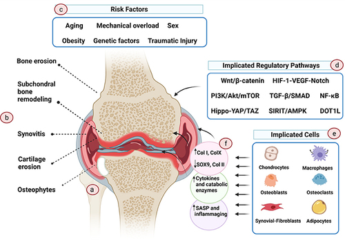 Figure 1 The pathophysiology of OA. OA is a complex disease with multi-factors and causes, which affects not only the cartilage tissue but also the surrounding tissues. (A) Pathological knee. (B) OA not only impacts cartilage but also exerts its effects on the surrounding tissues. This results in the modulation of the subchondral plate, synovial tissue inflammation, and the development of erosion and osteophytes in the supporting bone. (C) The primary etiological event responsible for OA remains largely elusive. Several risk factors have been proposed to augment susceptibility to OA, including aging, chronic mechanical overloading, traumatic injury, genetic predisposition, sex, and hormonal variations. (D) Numerous regulatory pathways contribute to the initiation and progression of OA, although not all are necessarily involved in every disease phenotype. (E) Cells within the affected tissues actively participate in the initiation and propagation of OA. (F) During the course of OA, these cells undergo phenotypic changes, leading to altered transcriptome profiles that perpetuate an unending cycle of inflammation and tissue deterioration. Reproduced with permission from Foo JB, Looi QH, How CW, et al. Mesenchymal Stem Cell-Derived Exosomes and MicroRNAs in Cartilage Regeneration: biogenesis, Efficacy, miRNA Enrichment and Delivery. Pharmaceuticals. 2021;14(11):56.Citation13 Copyright 2021, MDPI. Creative Commons.