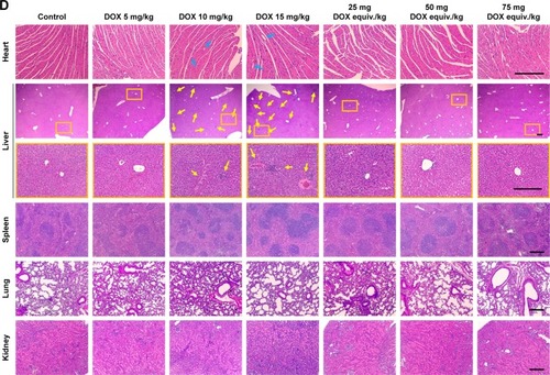 Figure 8 (A–C) Blood biochemical parameters LDH, ALT and AST and (D) pathological studies of heart, liver, spleen, lung and kidney in various drug formulations treated mice. Bar, 250 μm. Data are presented as the mean ± SD (n = 6, DOX 15 mg/kg, n = 5, *p < 0.05).Notes: The blue arrows and yellow arrows indicate the sites of cardiac injury and hepatic damage, respectively. The orange boxes represent the areas to be enlarged.Abbreviations: LDH, lactate dehydrogenase; ALT, alanine transaminase; AST, aspartate transaminase; DOX, doxorubicin.