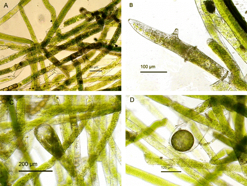 Figure 2  Vaucheria longicaulis. A, Vegetative siphons, Orakei Basin, 10 May 2010. B, Antheridium, Orakei Basin, 10 May 2010. C, Developing oogonium, Orakei Basin, 10 May 2010. D, Mature oospore, Orakei Basin, 10 May 2010.