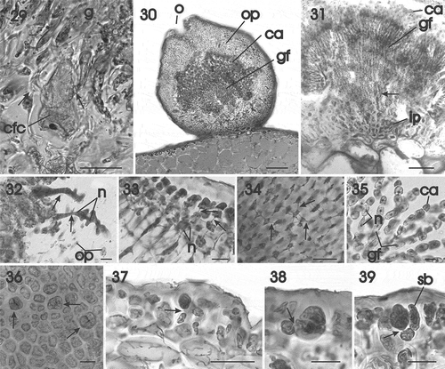 Figs 29–39. Gracilaria corallicola. Post-fertilization stages and tetrasporangia. Fig. 29. Carpogonial fusion cell incorporating vegetative cells (arrows) situated at base of mature gonimoblast filaments (HGI–A 10363). Fig. 30. Mature ostiolate cystocarp with narrow gonimoblast filaments bearing branched chains of carposporangia (HGI–A 10363). Fig. 31. Longitudinal section of inner pericarp and network of interconnected cells (arrow) from which the gonimoblast filaments arise (HGI–A 10363). Fig. 32. Multinucleate tubular filaments (arrows) originating from the gonimoblast and fusing with cells of the outer pericarp (HGI–A 16798). Fig. 33. Growing region of the outer pericarp with the inner cells connected by secondary pit connections (arrows) (HGI–A 16798). Fig. 34. Stellate cells of inner region of the outer pericarp, connected by secondary pit connections (arrows) (HGI–A 16798). Fig. 35. Gonimoblast filaments forming branched chains of carposporangia terminally (HGI–A 16798). Fig. 36. Scattered tetrasporangia in surface view (arrows) (HGI–A 10721). Fig. 37. Cross section of an inflated fertile area showing the latero–basal connection between a tetrasporangial initial and a subcortical cell (arrow) (HGI–A 11609). Fig. 38. Young once-divided tetrasporangium showing connection with subcortical cell (arrow) (HGI–A 11609). Fig. 39. Mature cruciately divided tetrasporangium pit-connected with subcortical cell (arrow) and surrounded by cortical filaments (HGI–A 11609). Scale bars: Figs 29, 37 = 50 µm; Fig. 30 = 200 µm; Fig. 31 = 100 µm; Figs 32–36, 38, 39 = 20 µm. Figs 29–30, 32–37 haematoxylin; Figs 31, 38, 39, aniline blue.Abbreviations: ca = carposporangium; cfc = carpogonial fusion cell; g = gonimoblast; gf = gonimoblast filament; ip = inner pericarp; n = nucleus; op = outer pericarp; sb = side branch.