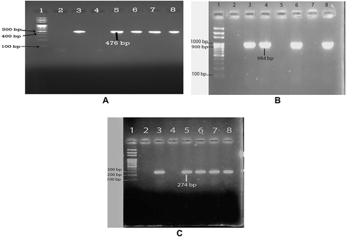 Figure 4 (A) Gel electrophoresis of PCR amplicon of blaNDM-1 gene (lane 1: DNA ladder 100bp; lane 2: negative control, lane 3: positive control, lane 5–8 blaNDM-1 gene), (B) Gel electrophoresis of PCR amplicon of blaNDM-2 gene (lane 1: DNA ladder 100bp; lane 2: negative control, lane 3: positive control, lane 4, lane 6 and lane 8 blaNDM-2 gene). (C) Gel electrophoresis of PCR amplicon of blaNDM-3 gene (lane 1: DNA ladder 100bp; Lane 2: negative control, Lane 3: Positive control, Lane 4, Lane 6 and Lane 8 blaNDM-2 gene).