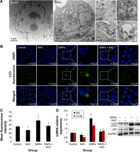 Figure 8 Induction of autophagy by SiNPs and reversed by NAC.Notes: (A) Induction of autophagy in HUVECs by 50 μg/mL SiNPs observed under TEM. Control shows typical distribution of organelles within vascular endothelial cells. SiNPs-treated cell shows appearance of numerous perinuclear vacuoles typical of an autophagic cell. The white and black arrows indicate damaged mitochondrial and impaired lysosome, respectively, whereas the red arrow indicates a double-membranous phagophore developing into an autophagosome; (a and b) early autophagic vacuoles (AVi) containing membrane-bound cytoplasmic material, (c and d) and late autophagic vacuoles (AVs) with partially degraded cytoplasmic materials. LC3B expression was determined by immunofluorescence. Images demonstrate enhanced LC3-positive dots in HUVECs under 50 μg/mL SiNPs exposure, (B and C) while NAC pretreatment reversed the elevated LC3 level to nearly normal state. (D) Quantification of LC3 and p62 expressions was done by quantitative real-time PCR at mRNA level, and by Western blot at corresponding protein level. Data represented are the mean ± SD from three independent experiments. *P<0.05 vs control; #P<0.05 for SiNPs vs SiNPs + NAC.Abbreviations: SiNPs, silica nanoparticles; NAC, N-acetylcysteine; HUVECs, human umbilical vein endothelial cells; TEM, transmission electron microscopy; PCR, polymerase chain reaction; SD, standard deviation; DAPI, 4′,6-diamidino-2-phenylindole.