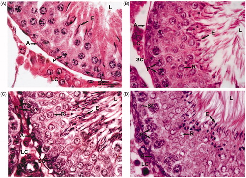 Figure 1. Testis histology of control (A) and Asparagus adscendens root extract treated rats at 100 (B), 200 (C), and 300 (D) mg/kg doses for 30 d. A, spermatogonia; P, pachytene spermatocytes; R, round spermatids; E, elongated spermatids; LC, Leydig cells; SC, Sertoli cells. Note the increased density of round and elongated spermatids in treated rats with 200 mg/kg (C) and 300 mg/kg (D) dose level. Magnification: ×1000 (under oil immersion); H–E staining.
