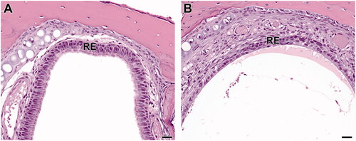 Figure 6. Level I sections of the nose from B6C3F1/N mice exposed to 2-ethyltoluene for 2 weeks via whole-body inhalation. In the control female mouse (A), the dorsal meatus of Level I is lined with respiratory epithelium (RE). In a female mouse exposed to 150 ppm 2-ethyltoluene (B), the respiratory epithelium atrophy is seen as attenuation and thinning of the respiratory epithelium (RE) in a Level I section of the nose. 40× original magnification, scale bar = 25 µm. H&E.
