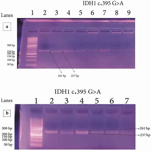 Figure 1. Detection of IDH1 c.395 G˃A mutation by RFLP-PCR analysis. Numbers refer to lanes. Lane 1 shows 50 bp DNA ladder. [A] Lane 2 showed PCR amplification product (undigested) with band at 261 bp; Lanes 3–9 showed single band at 237bp corresponding to wild type IDH1. [B] Lane 2–7 showed mutant variant of IDH1 with appearance of two closely placed bands (261 bp and 237 bp).
