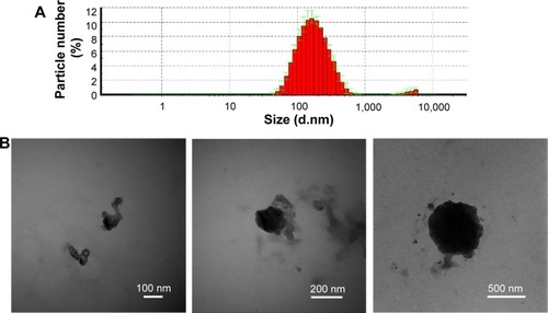 Figure 1 Chitosan/siRNA nanoparticle characterization.Notes: (A) Size distribution measured by dynamic light scattering at 20°C. (B) Three representative transmission electron microscope images of the nanoparticles.Abbreviation: d, diameter.