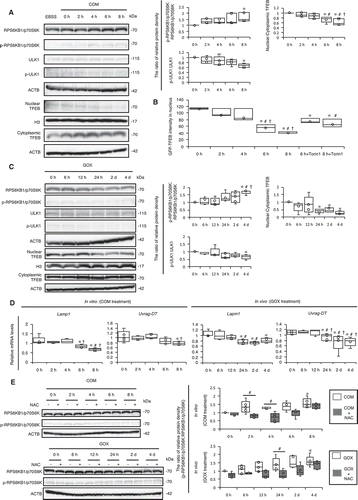 Figure 4. MTOR-TFEB axis was deregulated during kidney crystal formation. (A) Relative protein density, determined by western blotting of RPS6KB1/p70S6K, phosphorylated RPS6KB1/p70S6K (p-RPS6KB1/p70S6K), ULK1, phosphorylated ULK1 (p-ULK1), and nuclear and cytoplasmic TFEB in RTCs with COM exposure (n = 5). For starvation treatment, we cultured cells with EBSS for 2 h without COM. (B) Mean intensity of GFP-TFEB in nuclei of RTCs with COM exposure and/or Torin1. At least 30–50 cells were counted (n = 3). (C) Relative protein density, determined by western blotting (RPS6KB1/p70S6K, p-RPS6KB1/p70S6K, ULK1, p-ULK1, and nuclear and cytoplasmic TFEB) of kidneys extracted from LC3-mice with GOX injection (n = 5/group). (D) Quantification of gene expression (Lamp1 and Uvrag-DT) in RTCs with COM exposure and kidneys extracted from LC3-mice with GOX injection (n = 5). (E) Relative protein density, determined by western blotting of RPS6KB1/p70S6K and p-RPS6KB1/p70S6K in RTCs with COM exposure and/or NAC and of kidneys extracted from LC3-mice with GOX and/or NAC (n = 5). Each value at 0 h (A,C), COM 0 h and GOX 0 h (E) were adjusted to ‘1’ as a reference. *P < 0.05 versus 0 h, #P < 0.05 versus 2 h, and †P < 0.05 versus 4 h (A, B, D: in vitro); *P < 0.05 versus 0 h, #P < 0.05 versus 6 h, and †P < 0.05 versus 12 h (C, D: in vivo); *P < 0.05 versus COM and GOX 0 h and #P < 0.05 (E).