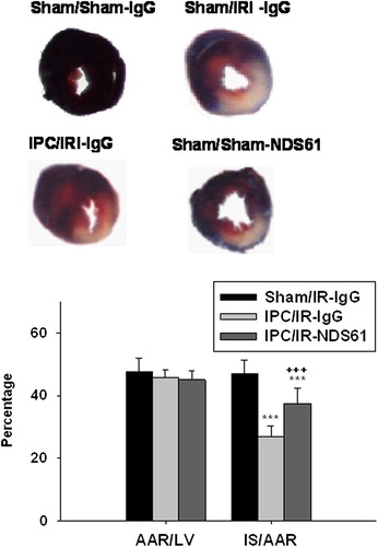 Figure 5. Treg cell depletion increases myocardial infarct size. On day-1, before 30-min myocardial ischemia, preconditioned rats were injected with NDS61 or control IgG. At the end of the 48-h reperfusion, the infarct size was determined by TTC staining (n = 8 per group). Values are expressed as mean ± S.D. ***p < 0.001 compared to Sham/IR-IgG; †††p < 0.001 compared to IPC/IR-IgG. LV, left ventricle; AAR, area at risk; IS, infarct size; IPC, ischemic preconditioning; IR, ischemia-reperfusion injury.