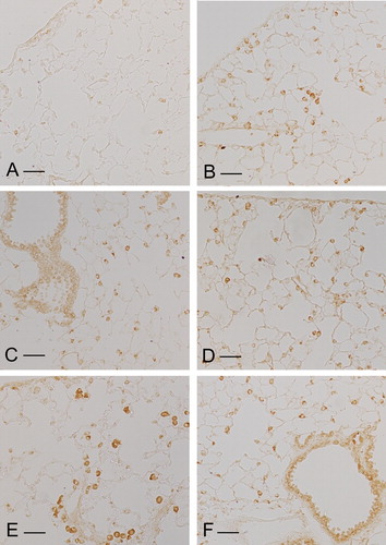 Figure 4. Immunohistochemical reaction for macrophage Mac-3 on lung parenchyma of ICR (A), C57 Bl/6 (B), DBA/2 (C), Lck deficient (D) and p66Shc ko (E, F) mouse. Mac-3 positive stained activated macrophages are seen throughout the lung parenchyma of C57 Bl/6, DBA/2, Lck deficient and p66Shc ko mice. Only few macrophages show this mark of activation in lungs of smoking resistant ICR mice. Scale bars = 50 µm.