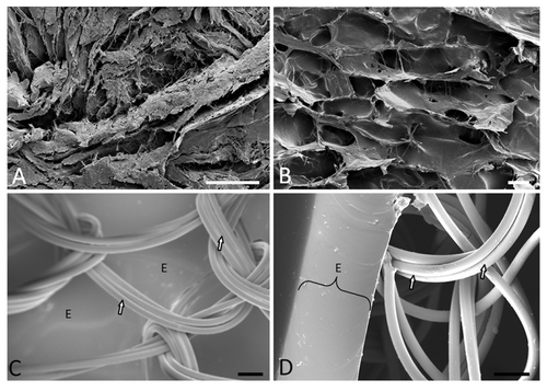 Figure 1. (A) Scanning Electron Microscopy (SEM) image demonstrating randomly distributed thick bundles of collagen (mainly type I) of acellular cadaver dermis (scale bar = 50 μm). (B) SEM of the fabricated collagen-based scaffolds show that they are not perfect copies of normal dermis and characteristically demonstrate large amounts of sheets, fibers and polygonal pores. This matrix was formed by using a 0.6% (w/w) collagen concentration and a controlled freeze rate of 0.92 °C/min (scale bar = 100 μm). (C) and (D) (scale bar = 100 μm): SEM of the nylon-based scaffolds with the epidermal portion (E) viewed from inferior and laterally (average thickness of 195.08 ± 3.70 μm). The bound knitted tri-filaments of the nylon mesh are indicated by the arrows.