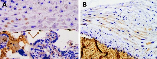 Figure 5 MMP1. Representative immunohistochemistry staining for MMP1 in the placental disc.