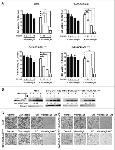 Figure 6 (See previous page). The decrease in cell viability induced by the Hh inhibitor was significantly enhanced by inhibiting autophagy. (A) K562, BaF3-BCR-ABL, BaF3-BCR-ABLT315I, and BaF3-BCR-ABLY253F cells were treated with 20 μM of vismodegib and 2.5, 5, or 10 μM of CQ for 48 h, cell viability was measured by CCK-8 assay. Data are means ± SD of triplicates. Typical results of 3 independent experiments are presented. *P < 0.05; **P < 0.01. (B and C) K562, BaF3-BCR-ABL, BaF3-BCR-ABLT315I, and BaF3-BCR-ABLY253F cells were cotreated with vismodegib (20 μM) and CQ (10 μM) or treated with vismodegib (20 μM) or CQ (10 μM) alone for 48 h, (B) then the protein levels of MAP1LC3B, and tubulin were measured by western blot assays, (C) cells were observed under inverted phase contrast microscope. Phase-contrast pictures were obtained randomly and representative pictures are presented.