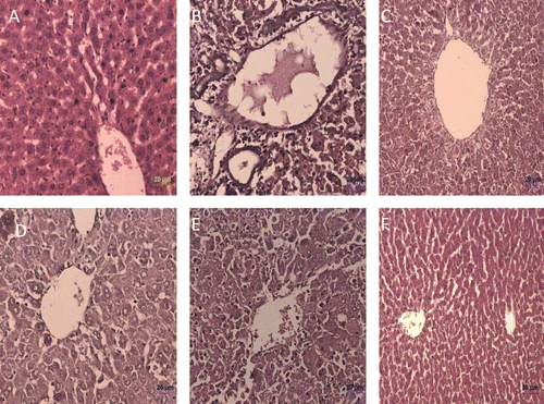 Figure 1.  Histological observation in liver sections (Hematoxylin and Eosin staining) of different experimental groups. (A) control, (B) toxic control (d-galactosamine, 500 mg/kg, i.p.), (C) standard (silymarin, 100 mg/kg), (D) B. nigra extract (200 mg/kg, p.o.) + d-galactosamine treated, (E) B. nigra extract (400 mg/kg, p.o.) + d-galactosamine treated, and (F) B. nigra extract (400 mg/kg, p.o.) alone treated.