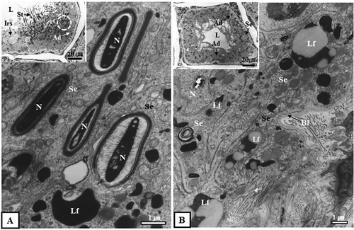 Figure 4. Optical and electron micrographs showing the phagocytosis process of Sertoli cells in seminiferous tubules in October. Note that many immature sperm cells were predated as part of the phagocytosis process of Sertoli cells (A, dotted circle in inset). In the lumen of the seminiferous tubules in October, there were sperm separating from Sertoli cells. Some sperm had already migrated from the lumen to the epididymis (B, inset). In addition, many lipofuscin granules were scattered within the cytoplasm of Sertoli cells (A, B). Ad, dark type spermatogonium; Bl, basal lamina; Irs, immature round spermatid; L, lumen; Lf, lipofuscin; S, sperm; N, nucleus; Se, Sertoli cell.